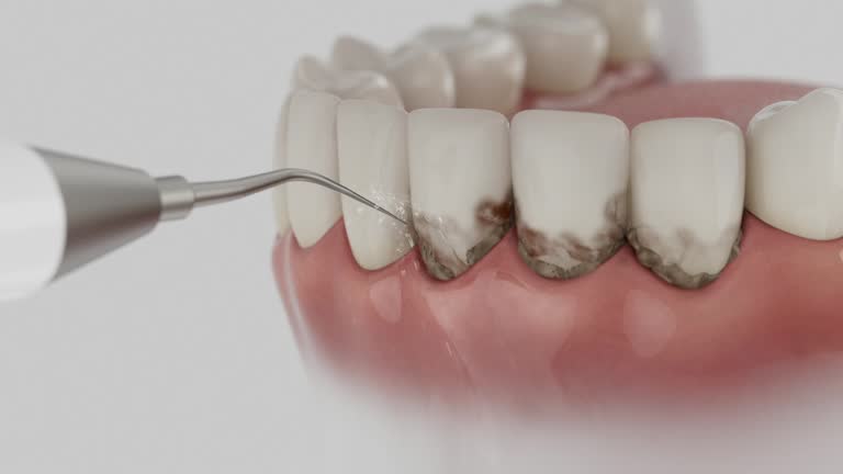 Reliable Tooth Extraction contractor in St. Albans, WV by Smile Center Dentistry